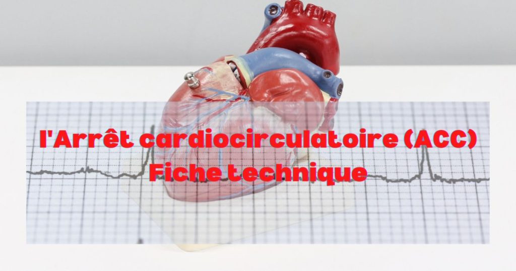 l'Arrêt cardiocirculatoire Fiche technique