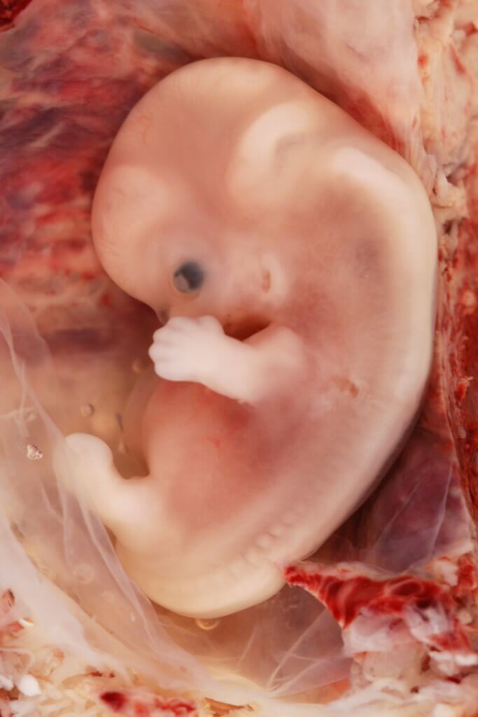 foetus 9 semaines