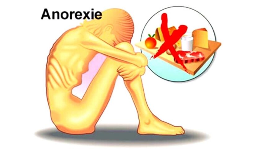 Anorexie mentale : causes, symptômes et traitements