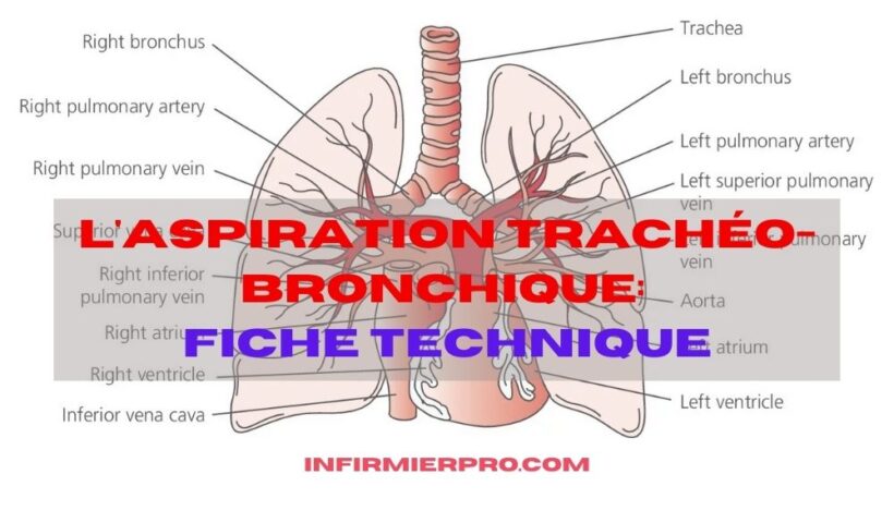 Aspiration-Tracheo-Bronchique