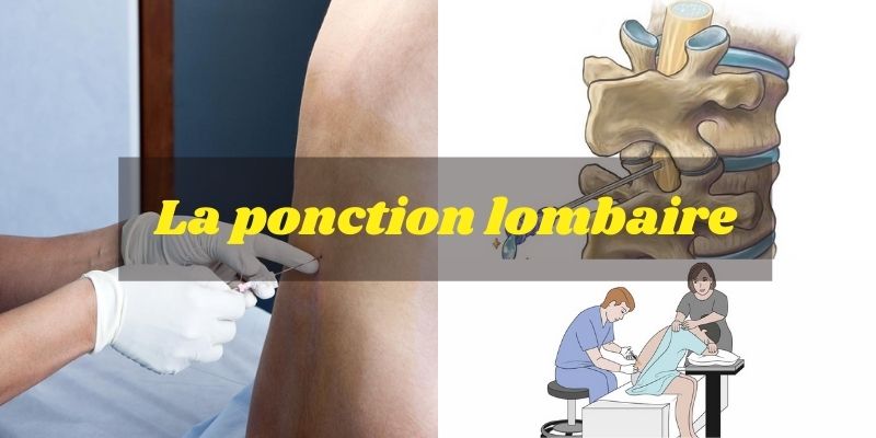La ponction lombaire, indications, Contre-indications