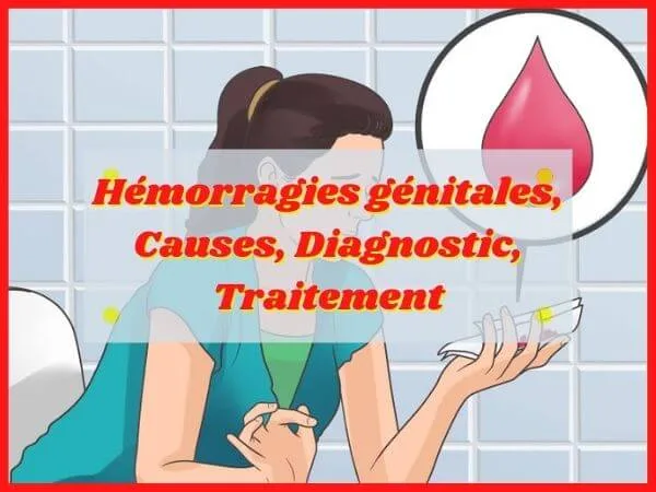 Hemorragies-genitales-chez-la-femme