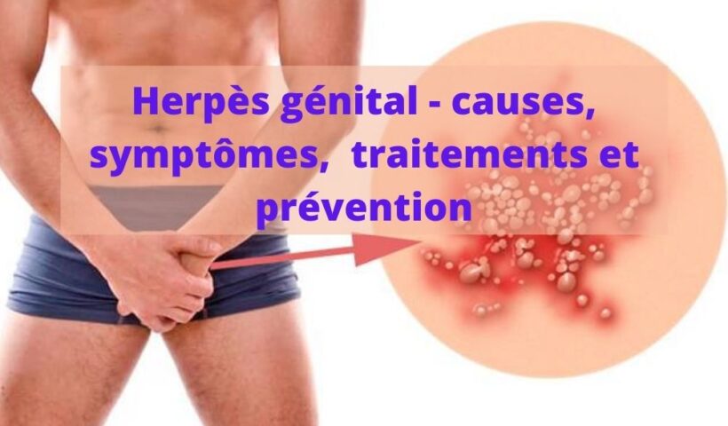 Herpes-genital-causes-symptomes-traitements-et-prevention