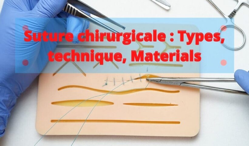 Suture-chirurgicale-Types-technique-Materials