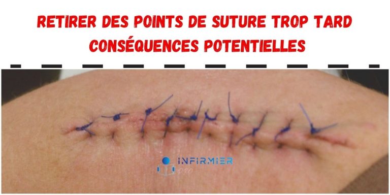 Retirer-des-points-de-suture-trop-tard-consequences-potentielles